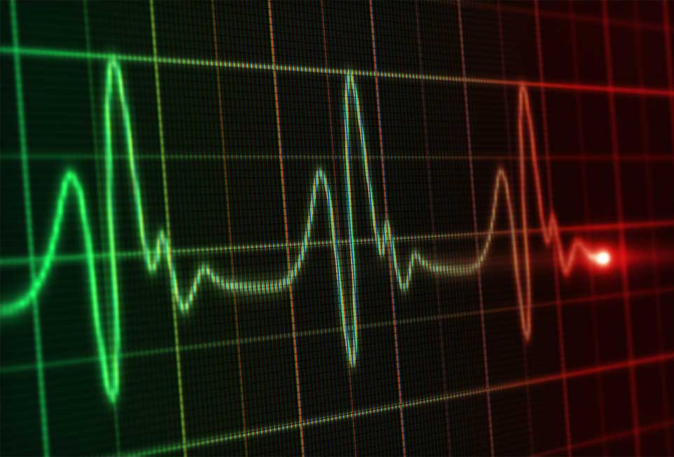 Congestive-Heart-Failure-Image Congestive-Heart-Failure-Image